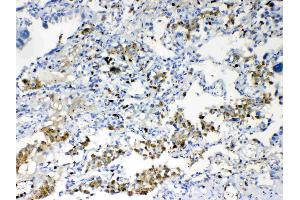 IHC analysis of TMEM107 using anti- TMEM107 antibody . (TMEM107 antibody  (N-Term))