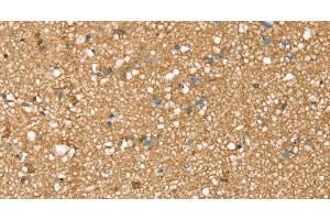 Immunohistochemistry of paraffin-embedded Human brain tissue using SDC3 Polyclonal Antibody at dilution 1:45 (SDC3 antibody)