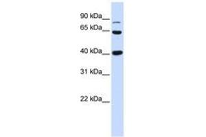 Image no. 1 for anti-Catenin (Cadherin-Associated Protein), beta 1, 88kDa (CTNNB1) (AA 684-733) antibody (ABIN6744377) (CTNNB1 antibody  (AA 684-733))