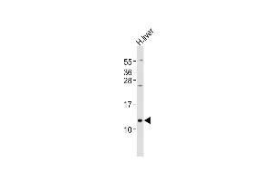 Anti-BRP44L Antibody (C-term)at 1:2000 dilution + human liver lysates Lysates/proteins at 20 μg per lane. (BRP44L antibody  (C-Term))