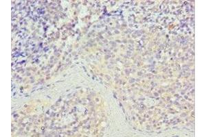 Immunohistochemistry of paraffin-embedded human tonsil tissue using ABIN7168977 at dilution of 1:100 (STK16 antibody  (AA 1-305))