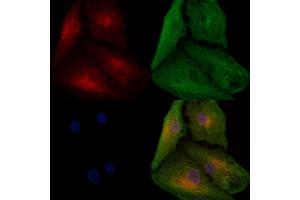 ABIN6266008 and ABIN6278040 staining  cells by IF/ICC.