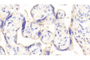 Immunohistochemistry (IHC) image for anti-ATG16 Autophagy Related 16-Like 1 (ATG16L1) (AA 342-607) antibody (ABIN7443884)