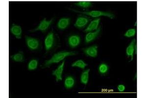 Immunofluorescence (IF) image for anti-Metalloproteinase Inhibitor 2 (TIMP2) antibody (ABIN781825) (TIMP2 antibody)