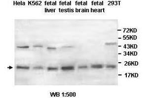 Image no. 1 for anti-Parkinson Protein 7 (PARK7) antibody (ABIN791232) (PARK7/DJ1 antibody)