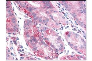Human Stomach: Formalin-Fixed, Paraffin-Embedded (FFPE) (TMEM33 antibody)