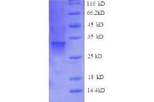 Chymotrypsin-Like Elastase Family Member 2a (CEL2A) (AA 31-271) protein (His tag)