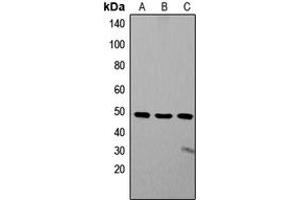 Western blot analysis of ZIC1/2/3 expression in SW480 (A), Jurkat (B), SHSY5Y (C) whole cell lysates. (ZIC1/2/3 antibody  (Center))