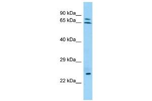 WB Suggested Anti-KRT74 Antibody Titration: 1. (KRT74 antibody  (N-Term))