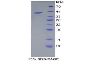 SDS-PAGE (SDS) image for Cadherin 5 (CDH5) (AA 59-382) protein (His tag) (ABIN1879530)