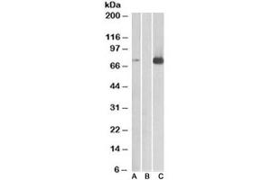 Western blot of HEK293 lysate overexpressing human MAP3K7/TAK1 with DYKDDDDK tag probed with TAK1 antibody [1ug/ml] in Lane A and probed with anti-DYKDDDDK tag (1/3000) in lane C. (TR4 antibody)
