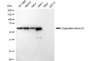 anti-Coagulation Factor IX (F9) antibody