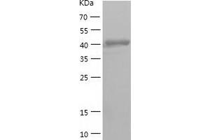 Western Blotting (WB) image for Calreticulin (CALR) (AA 18-417) protein (His tag) (ABIN7285822) (Calreticulin Protein (CALR) (AA 18-417) (His tag))
