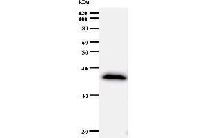 Western Blotting (WB) image for anti-Ankyrin Repeat Domain 11 (ANKRD11) antibody (ABIN933001) (ANKRD11 antibody)