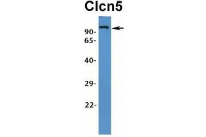Western Blotting (WB) image for anti-Chloride Channel 5 (CLCN5) (Middle Region) antibody (ABIN2776081)