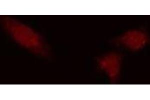 ABIN6275447 staining COLO205 cells by IF/ICC. (RAP1GAP antibody  (Internal Region))