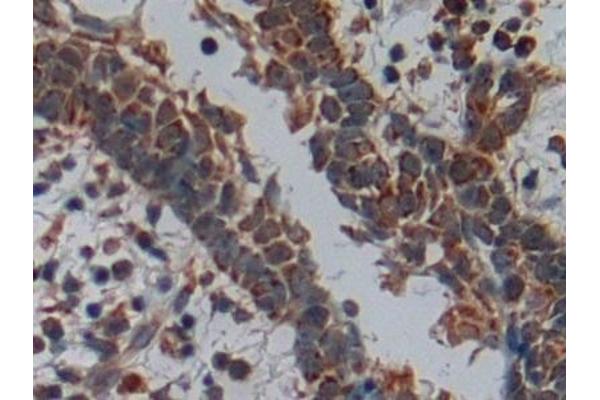 DISC1 antibody  (AA 102-261)