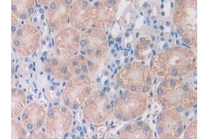 Immunohistochemistry (IHC) image for anti-alpha-2-HS-Glycoprotein (AHSG) (AA 19-250) antibody (ABIN7429511)