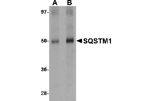 Western blot analysis of SQSTM1 in Human spleen tissue lysate with SQSTM1 antibody at (A) 1 and (B) 2 µg/mL. (SQSTM1 antibody  (C-Term))