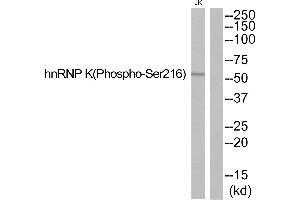 Western blot analysis of extracts from JurKat cells, using hnRNP K (Phospho-Ser216) antibody. (HNRNPK antibody  (pSer216))