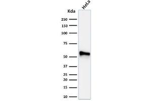 Western Blot Analysis of human HeLa cell lysate using Cytokeratin 7 Mouse Monoclonal Antibody (KRT7/760 + OV-TL12/30) (Cytokeratin 7 antibody)