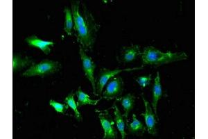 Immunofluorescent analysis of Hela cells using ABIN7164194 at dilution of 1:100 and Alexa Fluor 488-congugated AffiniPure Goat Anti-Rabbit IgG(H+L) (WTAP antibody  (AA 1-151))