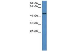 Image no. 1 for anti-HAUS Augmin-Like Complex, Subunit 8 (HAUS8) (AA 57-106) antibody (ABIN6746704) (NYS48/HAUS8 antibody  (AA 57-106))