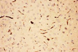 Anti-ACTH Picoband antibody, IHC(P): Rat Brain Tissue (POMC antibody  (Middle Region))