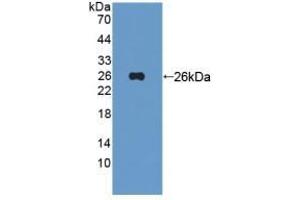 Detection of Recombinant Tie1, Human using Polyclonal Antibody to Tyrosine Kinase With Immunoglobulin Like And EGF Like Domains Protein 1 (Tie1) (TIE1 antibody  (AA 435-609))