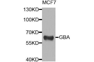Western blot analysis of extracts of MCF-7 cells, using GBA antibody. (GBA antibody  (AA 40-250))