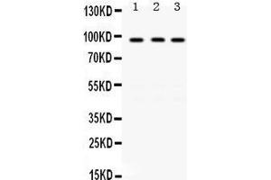Western Blotting (WB) image for anti-K(lysine) Acetyltransferase 2A (KAT2A) (AA 75-106), (N-Term) antibody (ABIN3042472) (KAT2A antibody  (N-Term))