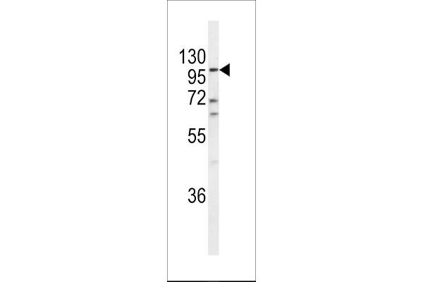 ECE1 anticorps  (AA 528-556)