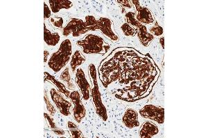 Immunohistochemical analysis of paraffin-embedded human kidney tissue using (ABIN6243087 and ABIN6577253) performed on the Leica® BOND RXm. (MME antibody  (AA 472-505))