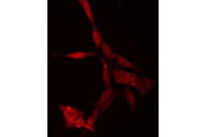 ABIN6274750 staining Hela cells by IF/ICC. (RPS18 antibody)