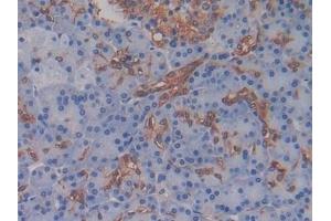 Detection of AMH in Human Pancreas Tissue using Monoclonal Antibody to Anti-Mullerian Hormone (AMH) (AMH antibody)