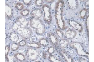 Detection of ICA1 in Human Kidney Tissue using Monoclonal Antibody to Islet Cell Autoantigen 1 (ICA1) (ICA1 antibody  (AA 1-258))