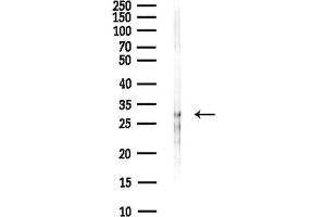 anti-Chromosome 1 Open Reading Frame 43 (C1orf43) antibody