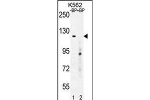 Western blot analysis of DEPD5 Antibody Pab pre-incubated without(lane 1) and with(lane 2) blocking peptide in K562 cell line lysate. (DEPDC5 antibody  (C-Term))