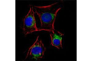 Immunofluorescence analysis of EC cells (rat aortic endothelial cells) using NGFR monoclonal antibody, clone 2F1C2  (green).