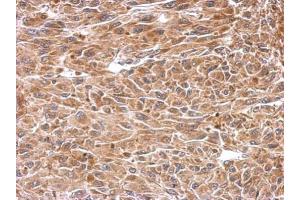 IHC-P Image Immunohistochemical analysis of paraffin-embedded U87 xenograft, using CESK1, antibody at 1:500 dilution. (CCT8L2 antibody  (C-Term))