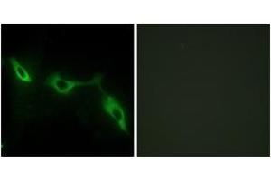 Immunofluorescence analysis of NIH-3T3 cells, using LEG9 Antibody. (Galectin 9 antibody  (AA 51-100))
