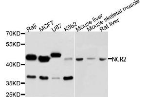 Western blot analysis of extracts of various cell lines, using NCR2 antibody (ABIN5995548) at 1/1000 dilution.