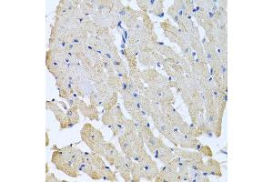 Immunohistochemistry of paraffin-embedded rat heart using GPLD1 antibody at dilution of 1:100 (40x lens).