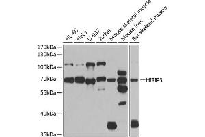 Western blot analysis of extracts of various cell lines, using HIRIP3 antibody (ABIN6128019, ABIN6141779, ABIN6141780 and ABIN6222788) at 1:1000 dilution. (HIRIP3 antibody  (AA 417-556))