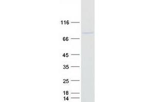 C3orf15 Protein (Myc-DYKDDDDK Tag)