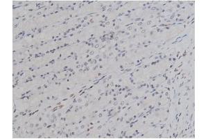 ABIN6256754 and ABIN6267331 at 1/200 staining Rat ganstric tissue sections by IHC-P. (LYN antibody  (pTyr508))