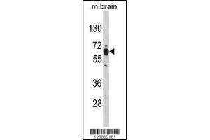Western blot analysis of PHGDH Antibody in mouse brain tissue lysates (35ug/lane)