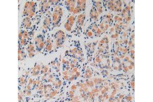 IHC-P analysis of stomach tissue, with DAB staining. (Peroxiredoxin 2 antibody  (AA 6-164))