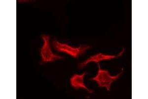 ABIN6275171 staining HeLa by IF/ICC. (DIRAS1 antibody  (C-Term))