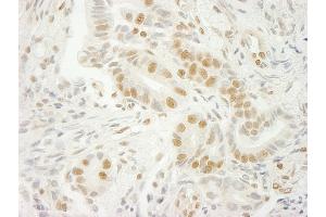 anti-U2 Small Nuclear RNA Auxiliary Factor 1 (U2AF1) (AA 140-190) antibody